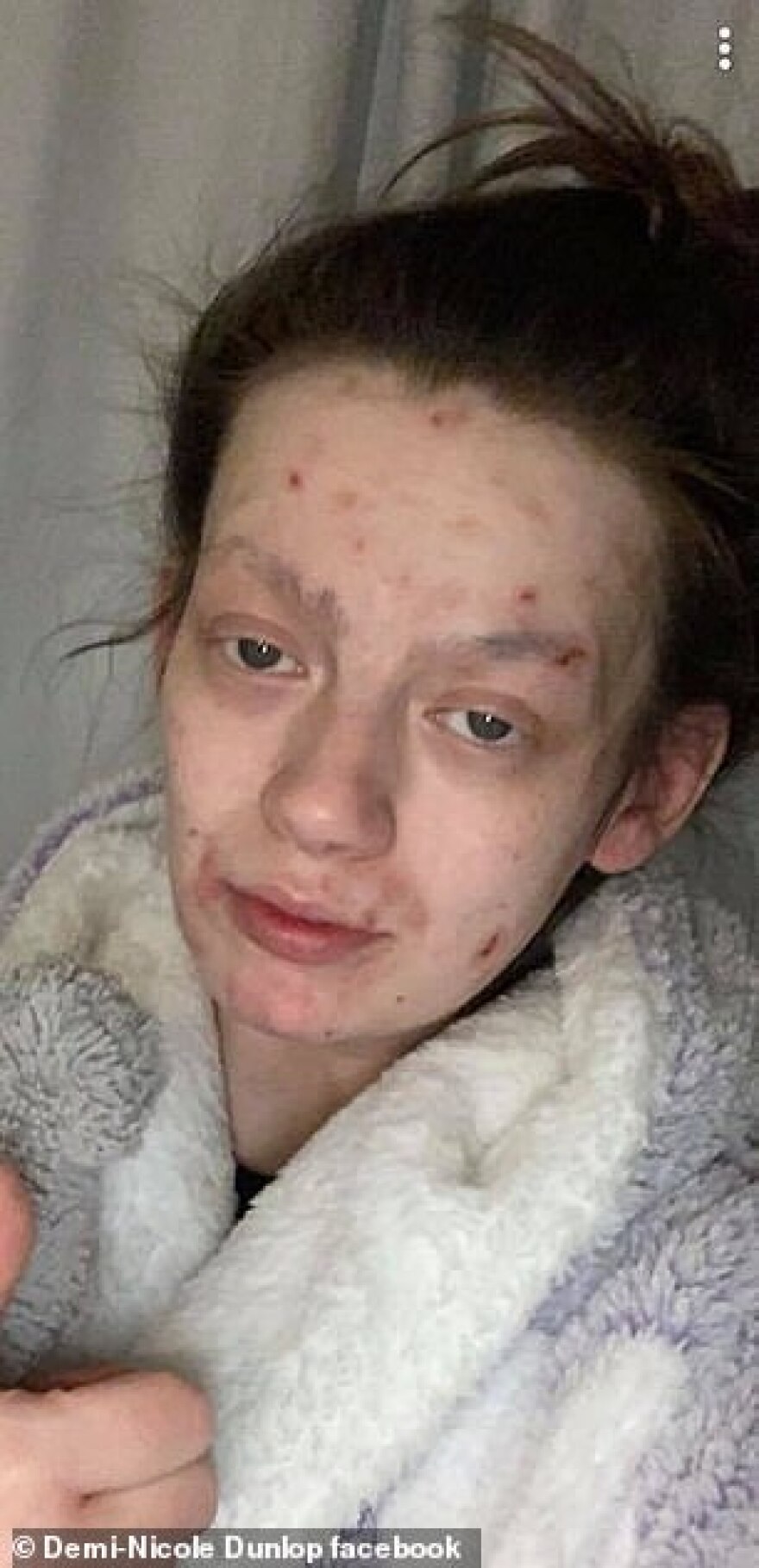 Έκοψε τα ναρκωτικά και…μεταμορφώθηκε (φωτογραφίες)