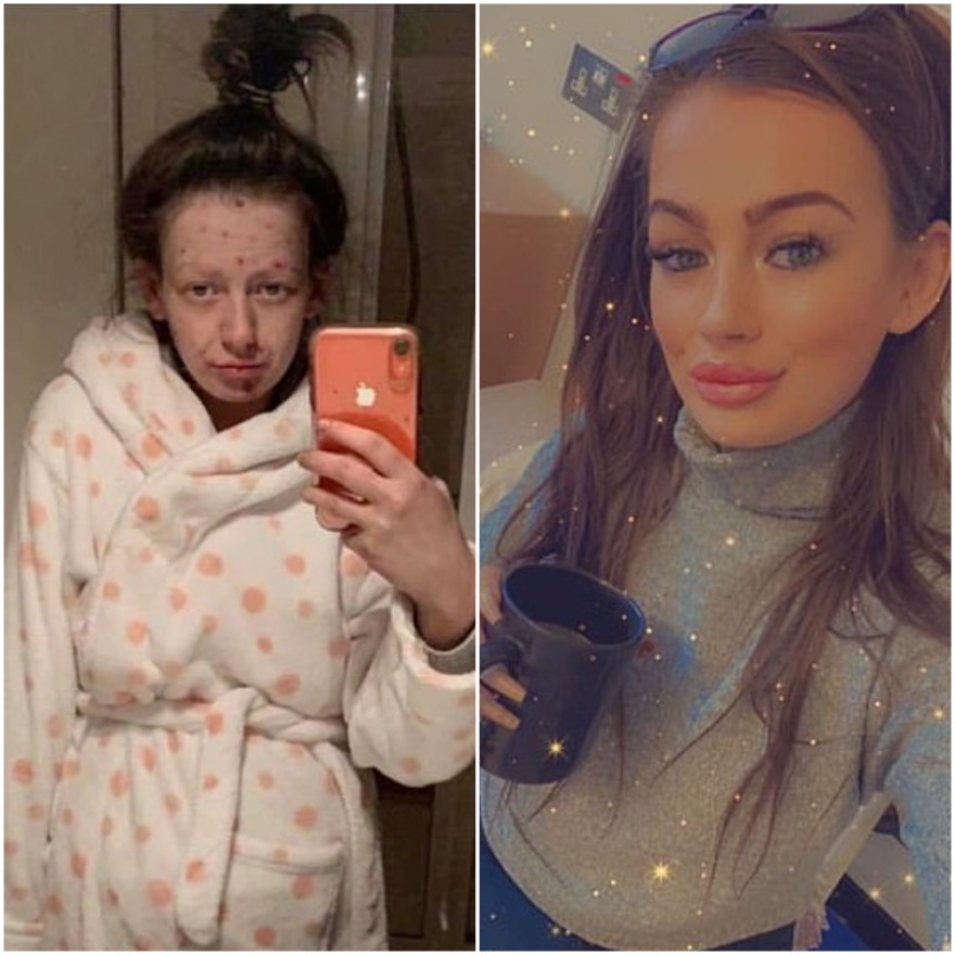 Έκοψε τα ναρκωτικά και…μεταμορφώθηκε (φωτογραφίες)