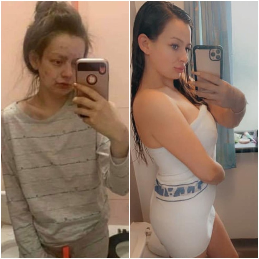 Έκοψε τα ναρκωτικά και…μεταμορφώθηκε (φωτογραφίες)