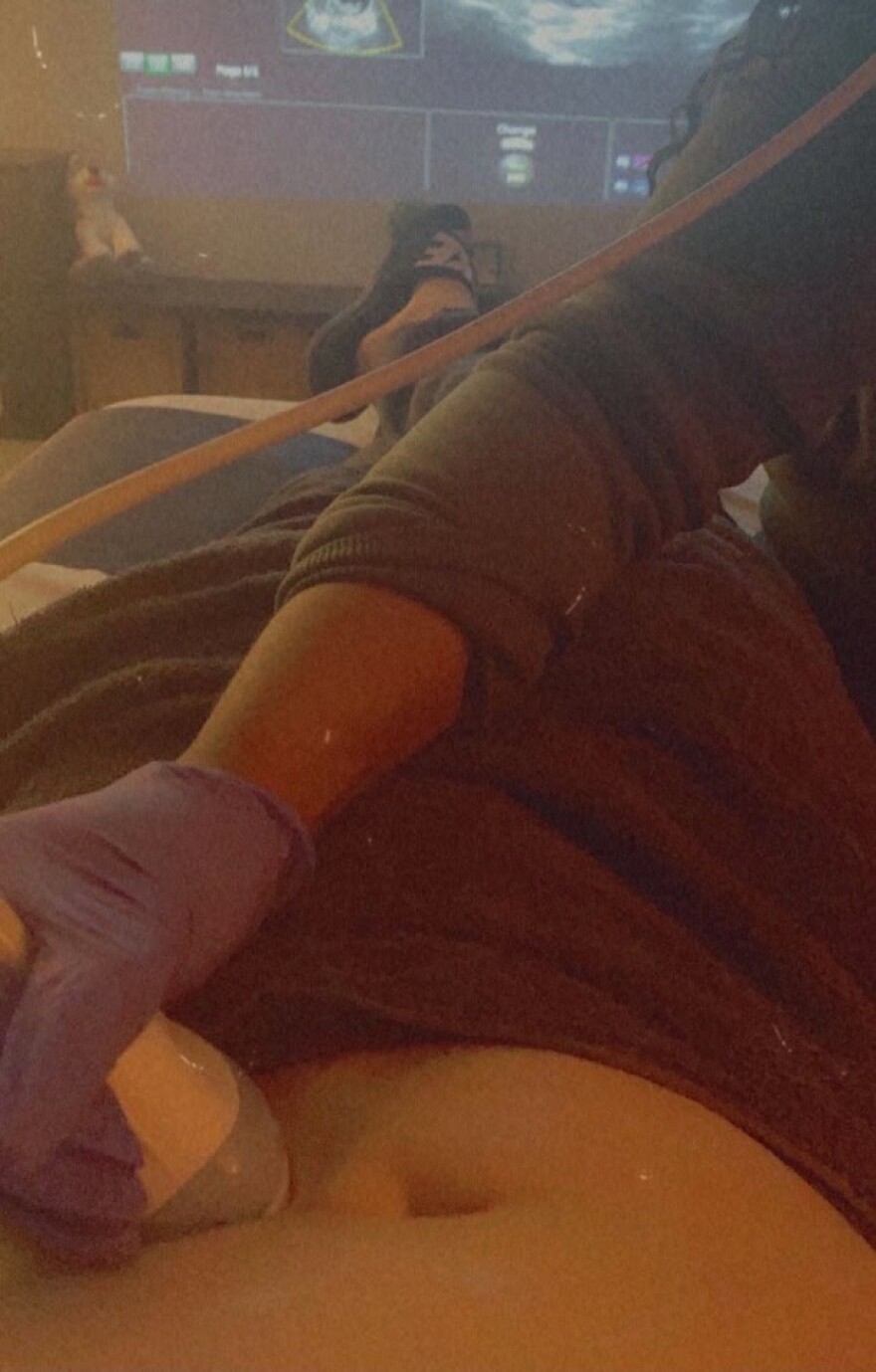 Η συγκλονιστική ιστορία της Μάικι Τσάνελ: Ο τρανσέξουαλ που ήθελε να γίνει μάνα και… θα γίνει!