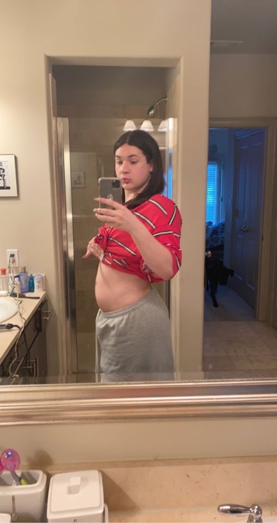 Η συγκλονιστική ιστορία της Μάικι Τσάνελ: Ο τρανσέξουαλ που ήθελε να γίνει μάνα και… θα γίνει!