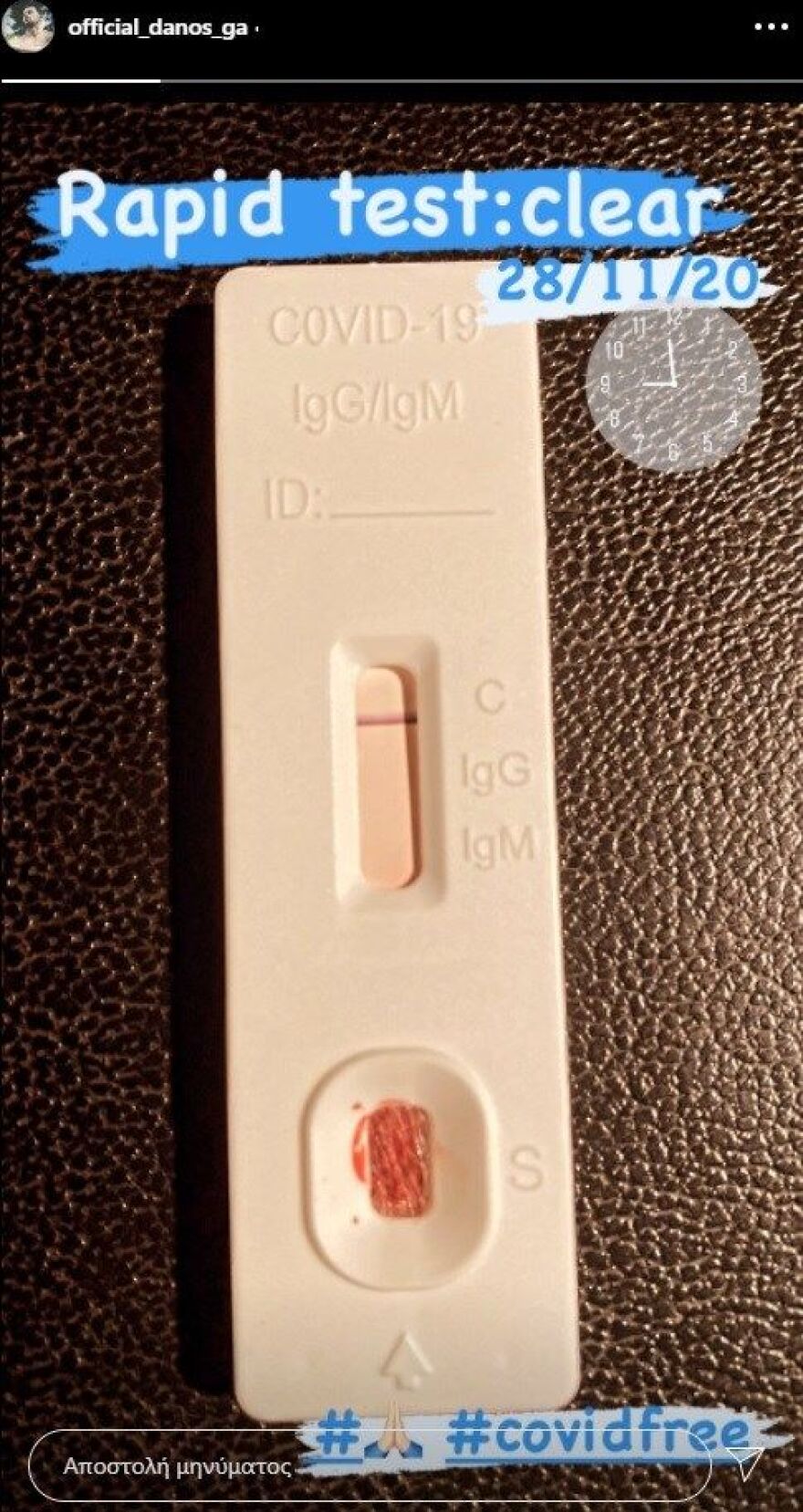 Ο Γιώργος Αγγελόπουλος μοιράστηκε το αποτέλεσμα του τεστ κορωνοϊού