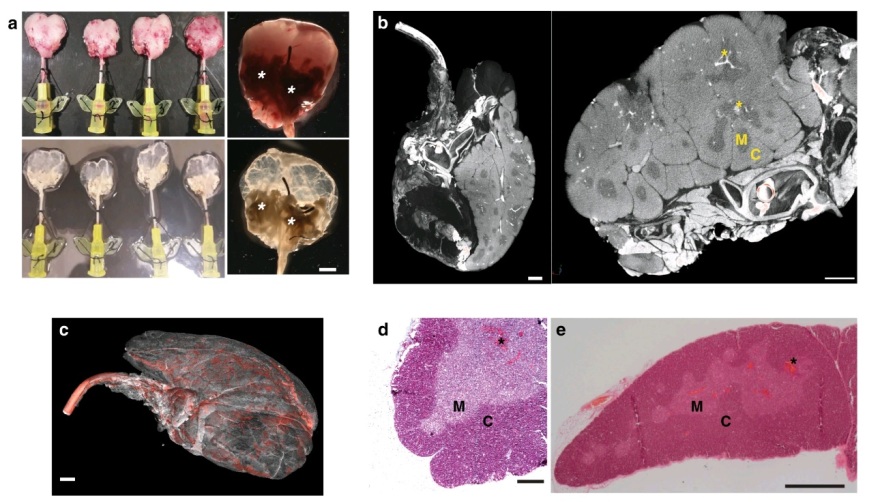 Βρετανία: Επιστήμονες δημιούργησαν έναν πλήρως λειτουργικό εργαστηριακό θύμο αδένα 