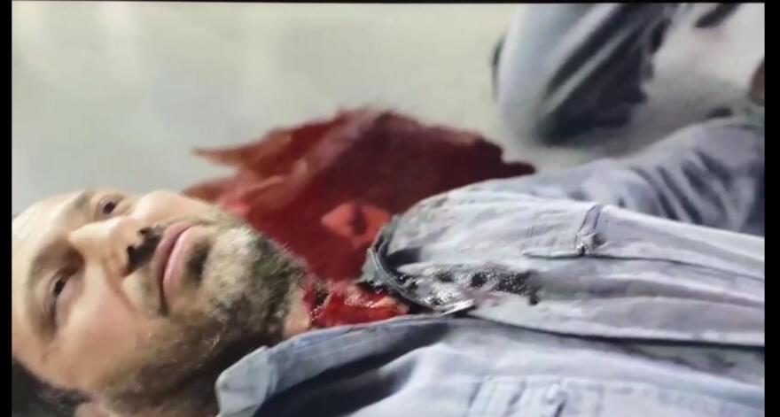 Η «επίθεση» στον Δημήτρη Σειρηνάκη από ψυχασθενή κρατούμενο