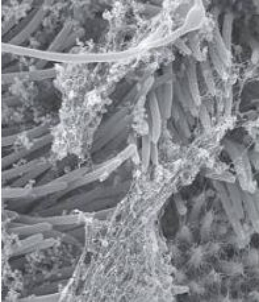 Κορωνοϊός: Δείτε φωτογραφίες πώς προσβάλλει τα κύτταρα του αναπνευστικού 