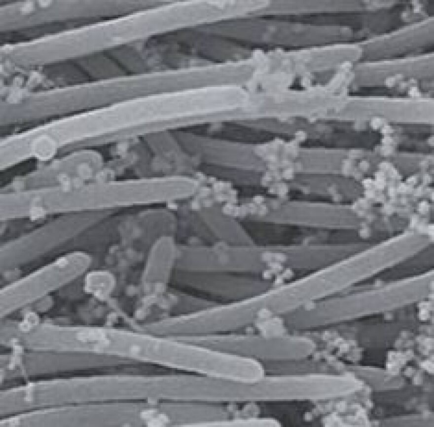 Κορωνοϊός: Δείτε φωτογραφίες πώς προσβάλλει τα κύτταρα του αναπνευστικού 