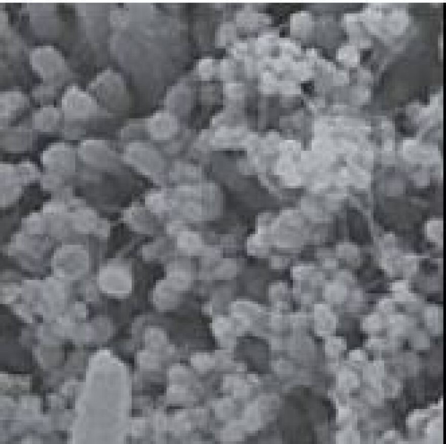 Κορωνοϊός: Δείτε φωτογραφίες πώς προσβάλλει τα κύτταρα του αναπνευστικού 