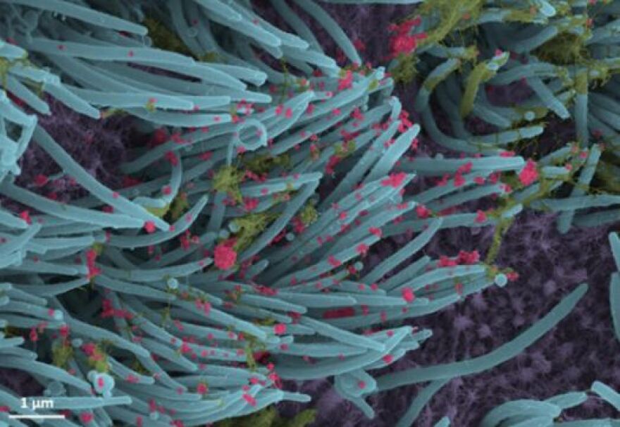 Κορωνοϊός: Δείτε φωτογραφίες πώς προσβάλλει τα κύτταρα του αναπνευστικού 