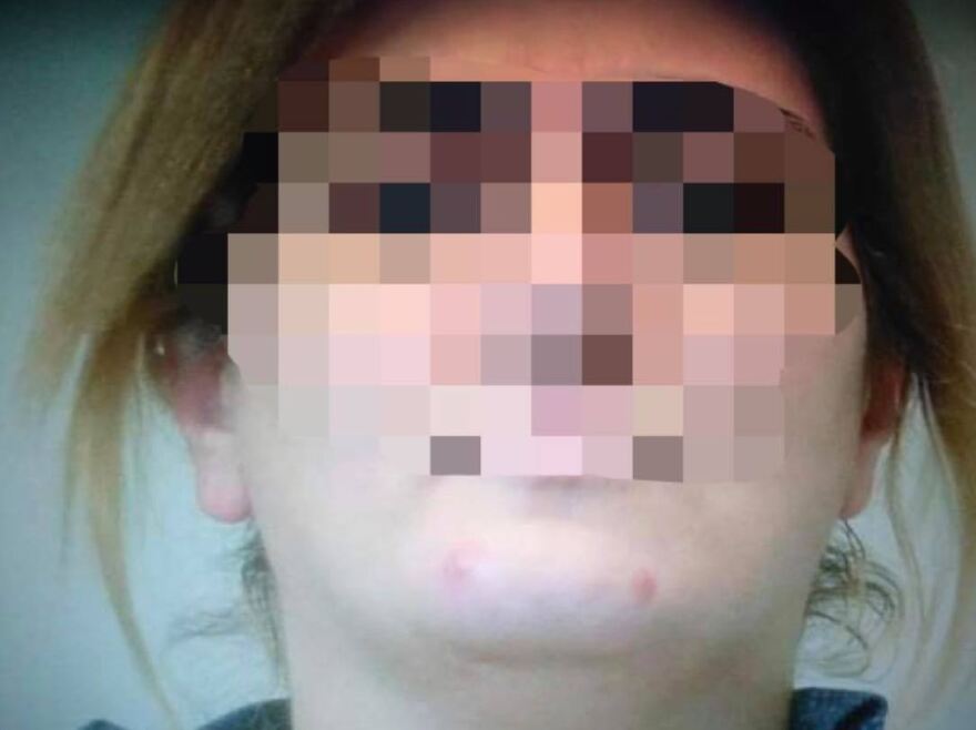 Συνελήφθη η Γεωργιανή οικιακή βοηθός που ξάφριζε κοσμήματα μεγάλης αξίας από τα σπίτια στα οποία εργαζόταν