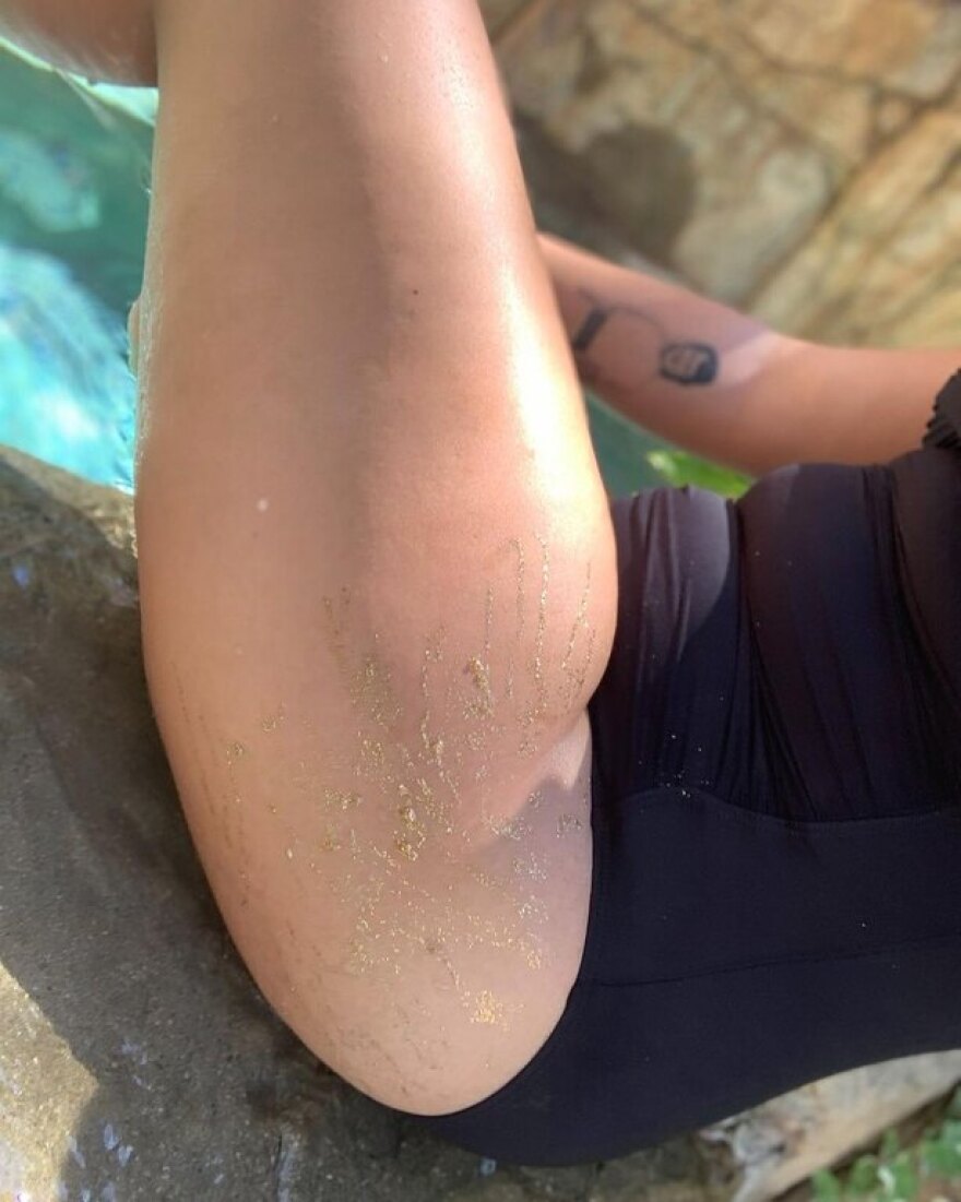 Ντέμι Λοβάτο: Δείχνει τις ραγάδες της 