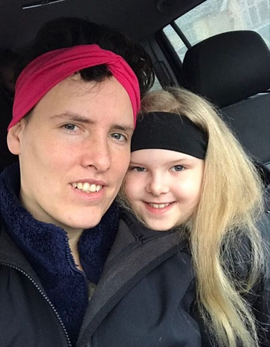 Βρετανία: Το κοριτσάκι με την ασυνήθιστα μεγάλη «χαίτη»