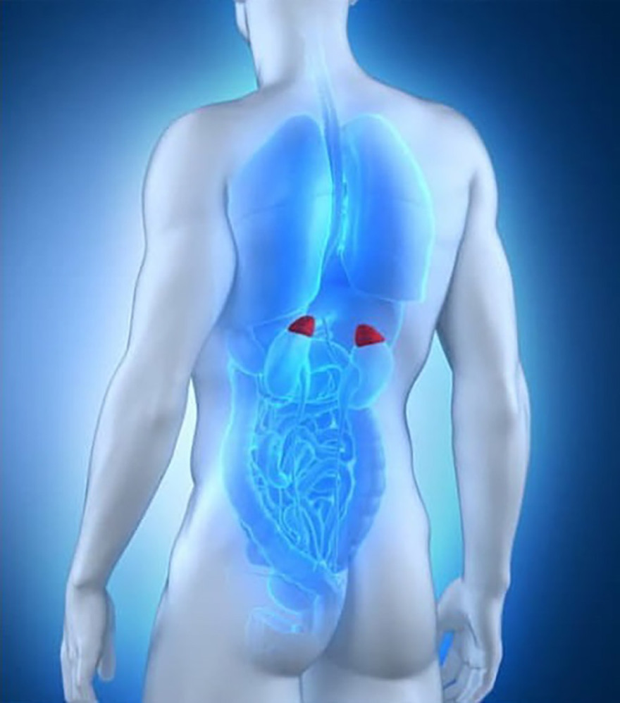 Χειρουργική αφαίρεση επινεφριδίων: Πότε χρειάζεται