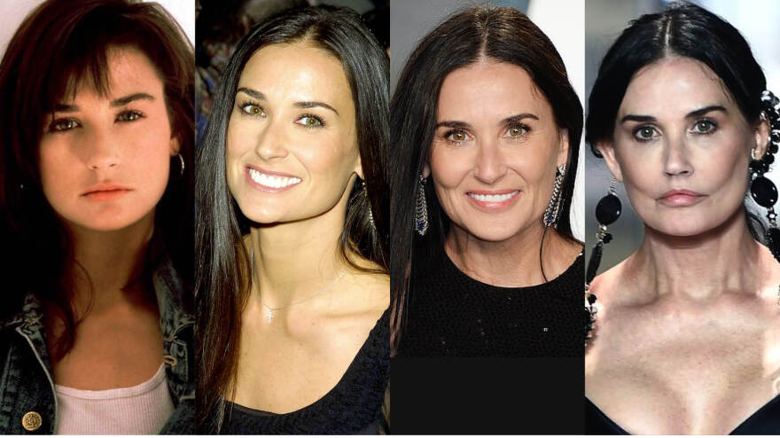 Ντέμι Μουρ: «Αγνώριστη» μετά από πλαστική - Έγινε σαν τον... «Τζόκερ»!