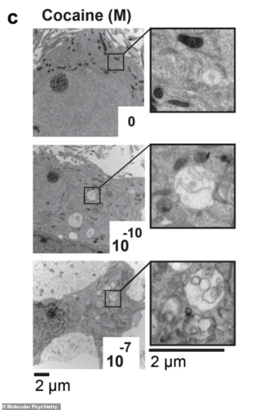 Αποκαλυπτική μελέτη για την κοκαΐνη: Πώς μετατρέπει σε... κανίβαλους τα εγκεφαλικά κύτταρα!