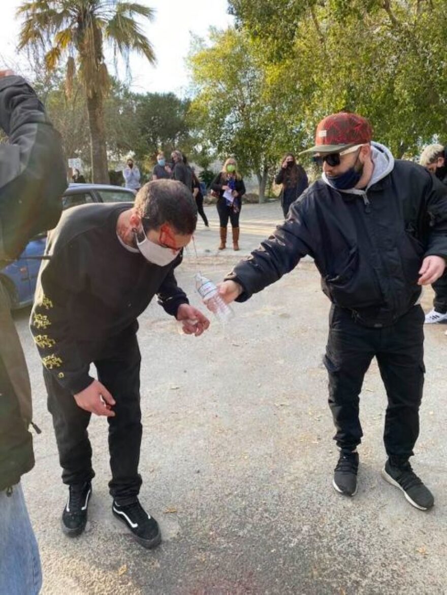 Στο σκαμνί η κυπριακή αστυνομία για υπέρμετρη βία κατά διαδηλωτών