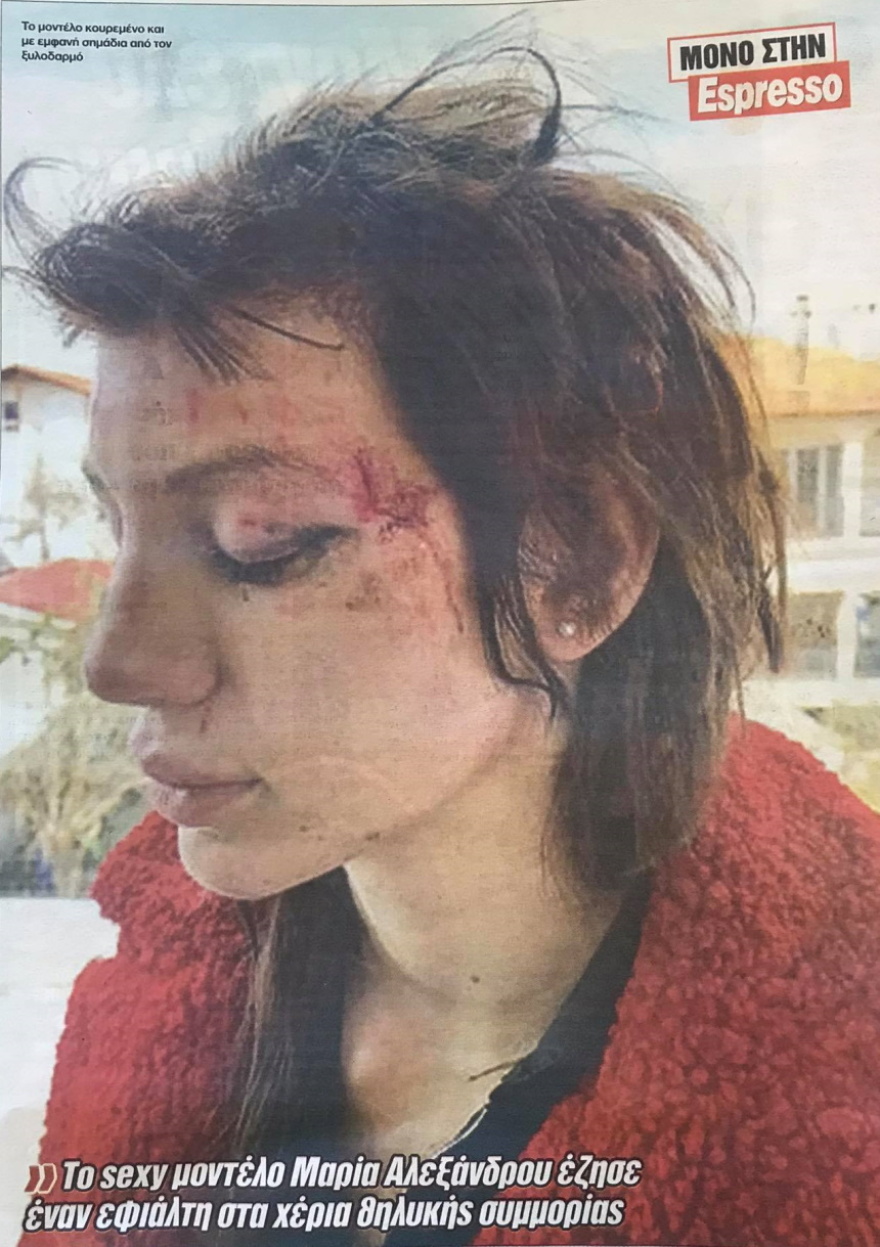 Εφιάλτης για τη Μαρία Αλεξάνδρου: Έξι γυναίκες την απήγαγαν, την χτύπησαν και την κούρεψαν - Φωτογραφίες σοκ