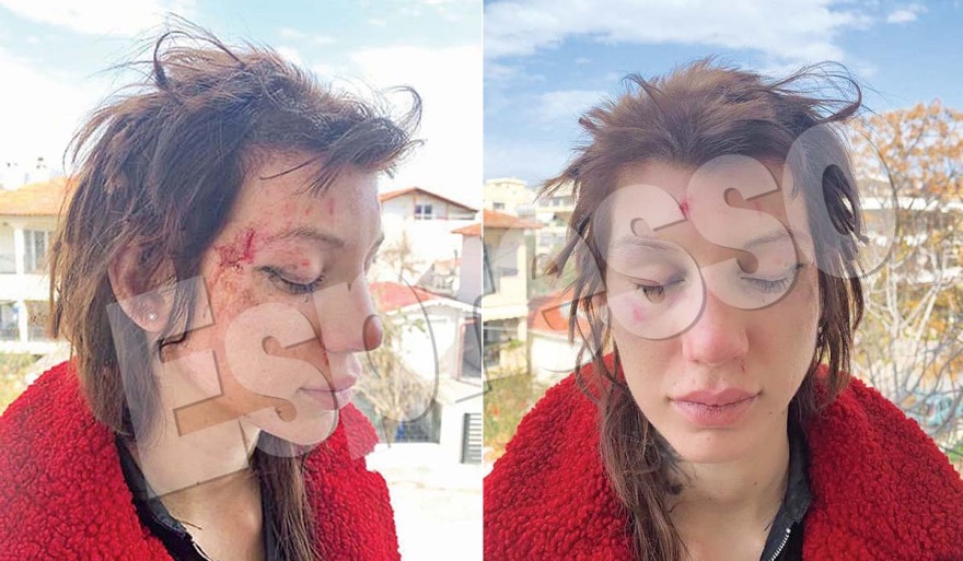 Εφιάλτης για τη Μαρία Αλεξάνδρου: Έξι γυναίκες την απήγαγαν, την χτύπησαν και την κούρεψαν - Φωτογραφίες σοκ