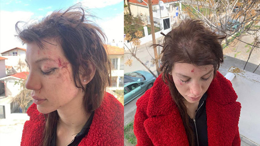 Η Μαρία Αλεξάνδρου μιλά στο protothema.gr για τον ξυλοδαρμό της - «Όλα έγιναν για έναν άντρα, από τότε έχω φοβίες»