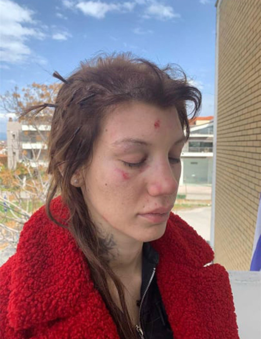 Η Μαρία Αλεξάνδρου μιλά στο protothema.gr για τον ξυλοδαρμό της - «Όλα έγιναν για έναν άντρα, από τότε έχω φοβίες»