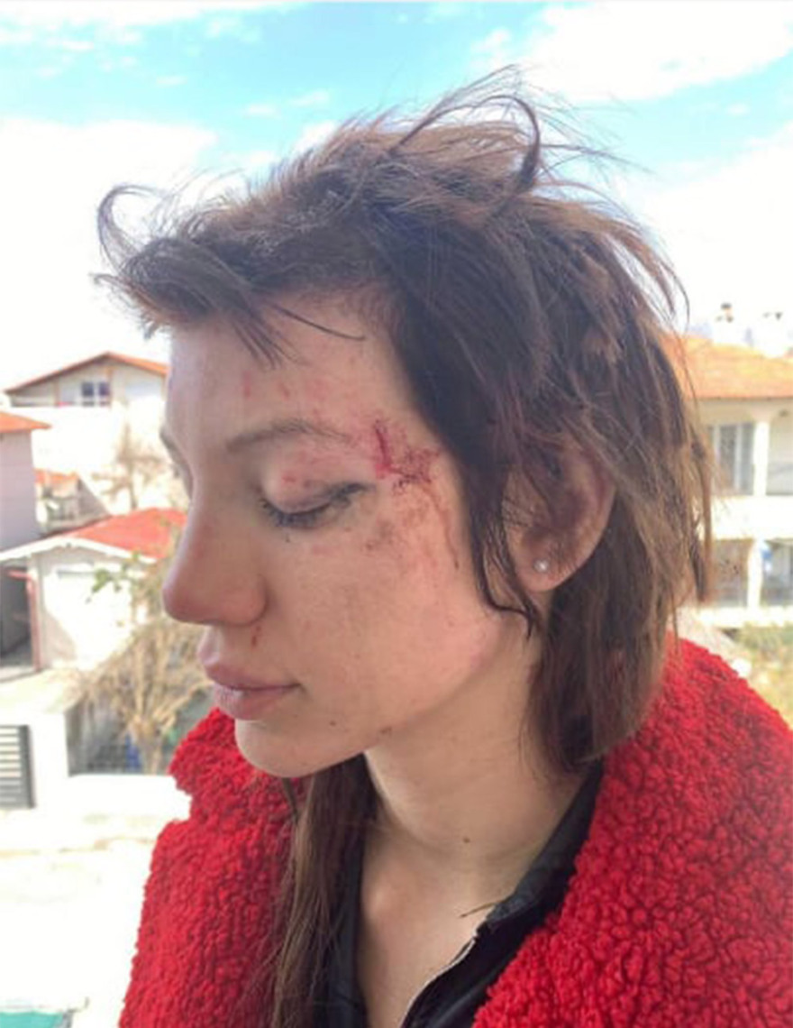 Η Μαρία Αλεξάνδρου μιλά στο protothema.gr για τον ξυλοδαρμό της - «Όλα έγιναν για έναν άντρα, από τότε έχω φοβίες»