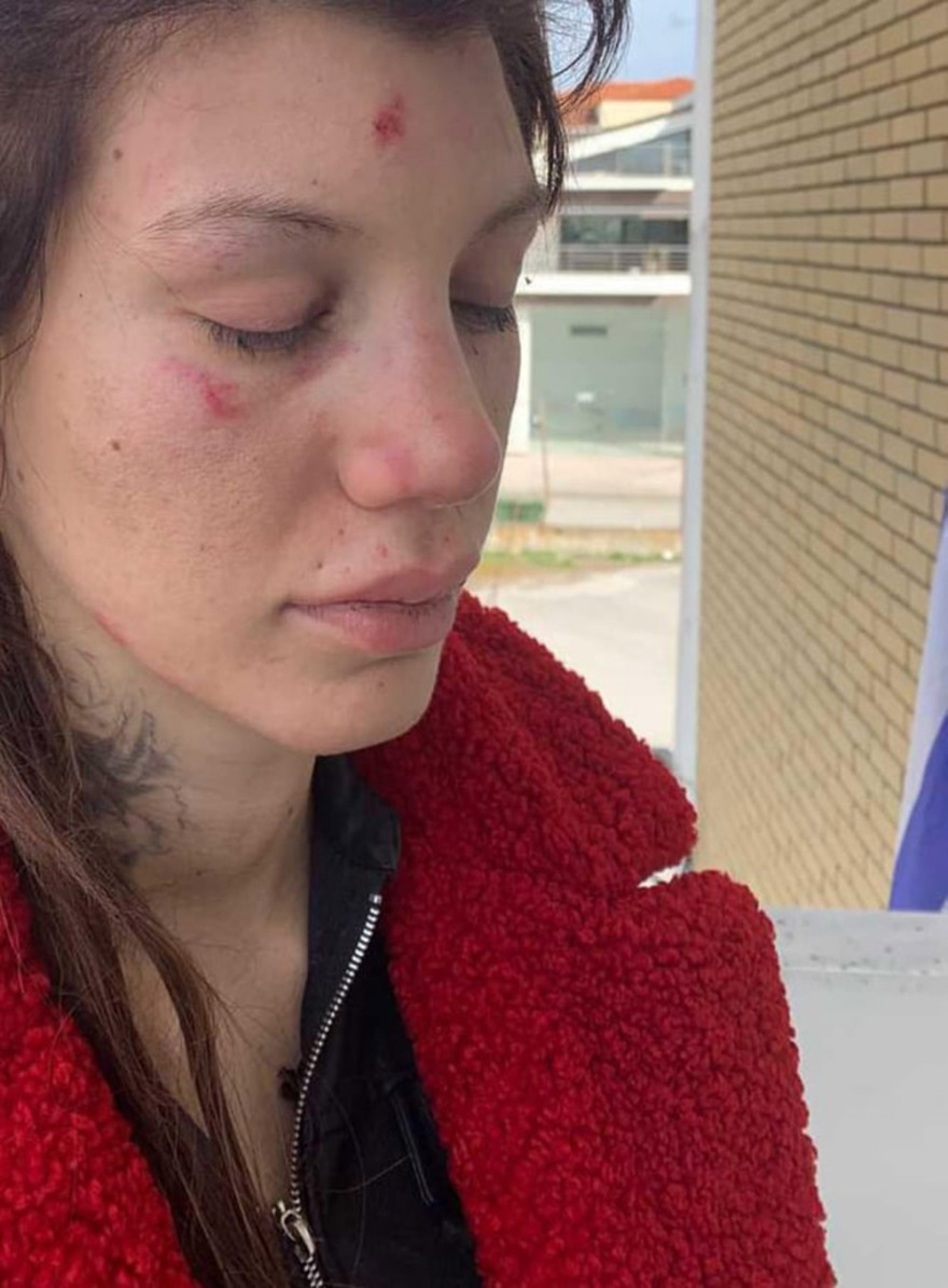 Η Μαρία Αλεξάνδρου μιλά στο protothema.gr για τον ξυλοδαρμό της - «Όλα έγιναν για έναν άντρα, από τότε έχω φοβίες»