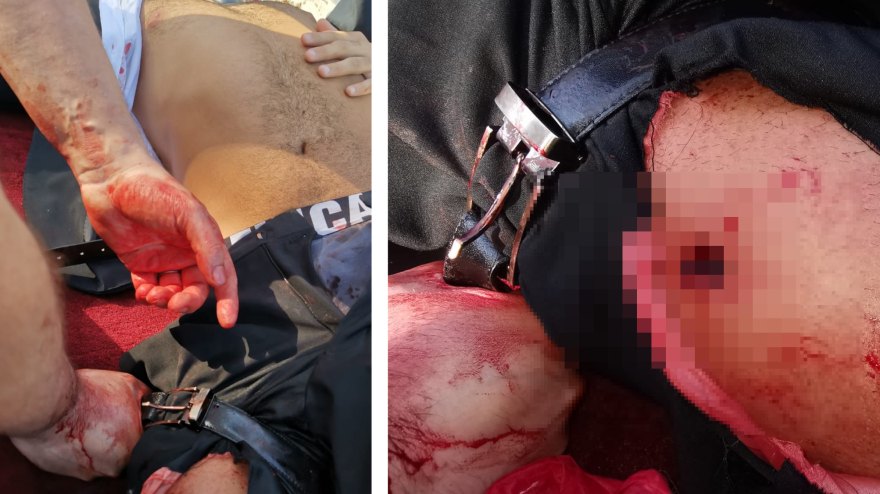 Ο γολγοθάς του Έλληνα αστυνομικού που έπεσε θύμα τρομοκρατικής επίθεσης στη Σαουδική Αραβία