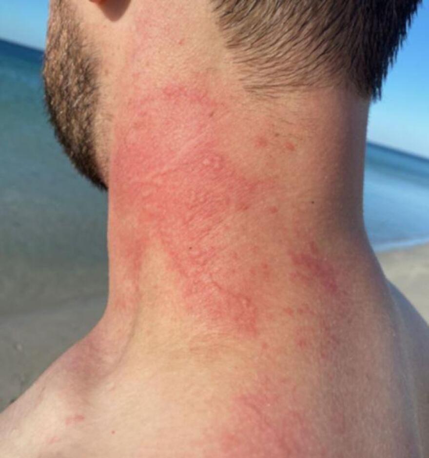 Αυστραλία - Απίστευτο περιστατικό: Θυμωμένο χταπόδι επιτέθηκε άγρια σε άνδρα που κολυμπούσε