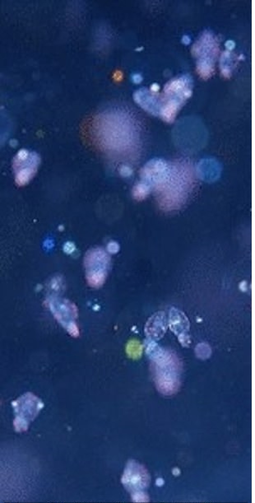 Νορβηγία: Μυστήριο με γιγαντιαίες μάζες στη θάλασσα που περιέχουν αβγά καλαμαριών– Δείτε φωτογραφίες