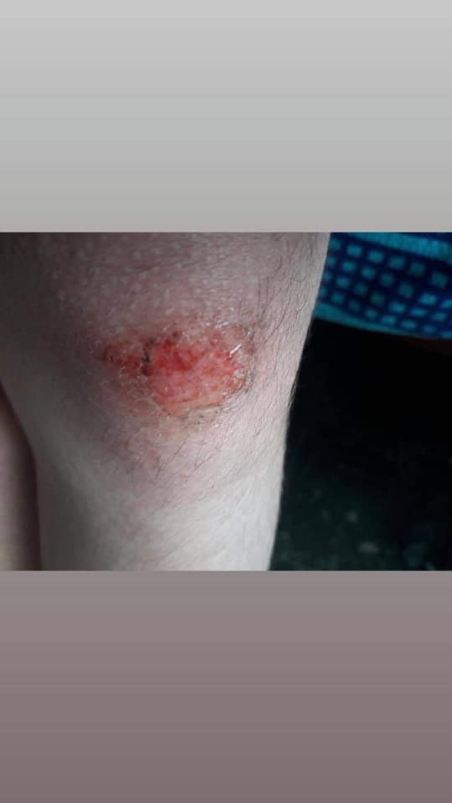 Τροχαίο στην Κεφαλονιά: Πήρα το παιδί μου σε ημιλιπόθυμη κατάσταση