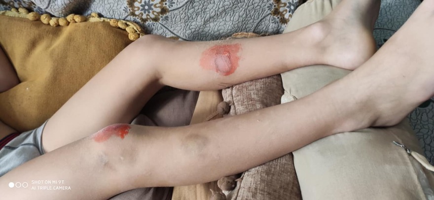 Τροχαίο στην Κεφαλονιά: Πήρα το παιδί μου σε ημιλιπόθυμη κατάσταση