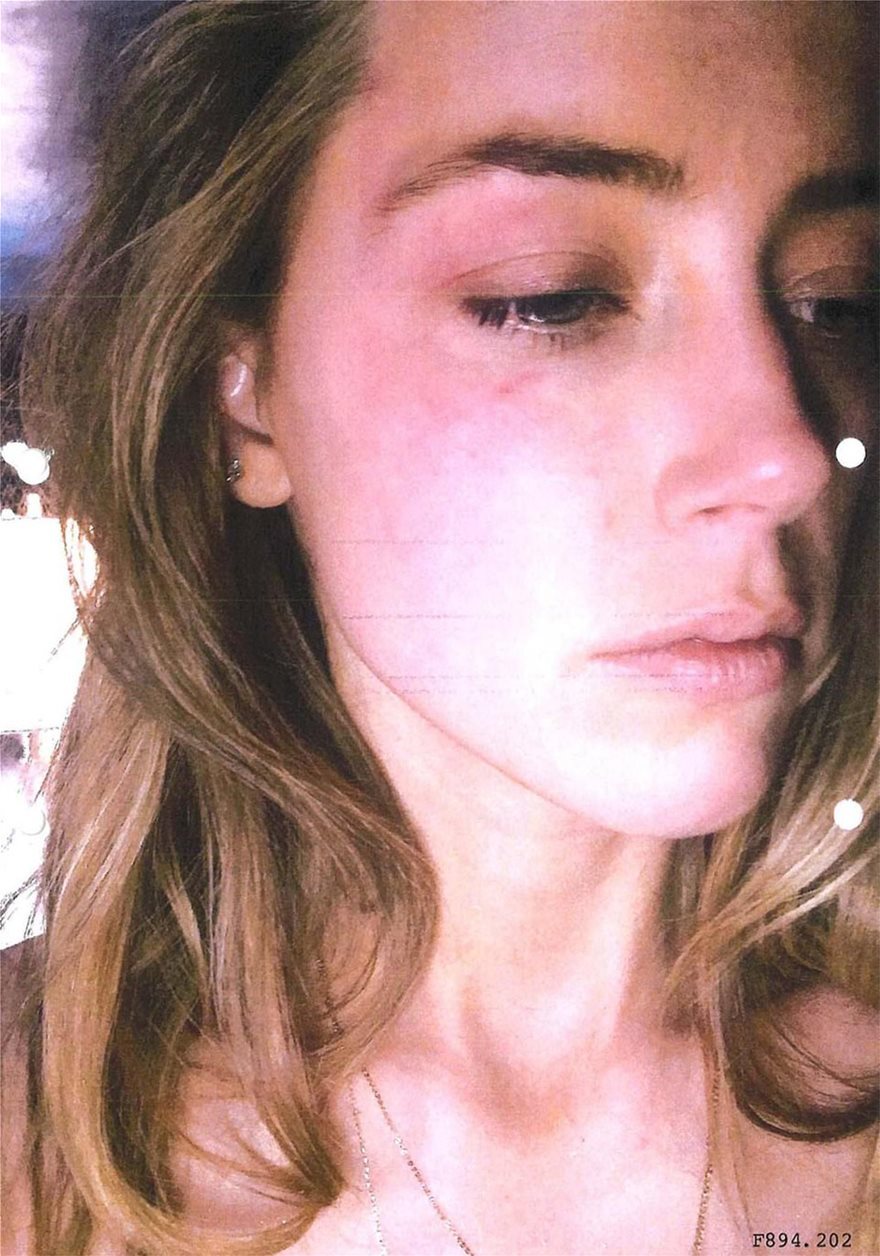 Η «πτώση» του Τζόνι Ντεπ: Έγινε ντοκιμαντέρ η διαμάχη του με την Άμπερ Χερντ 