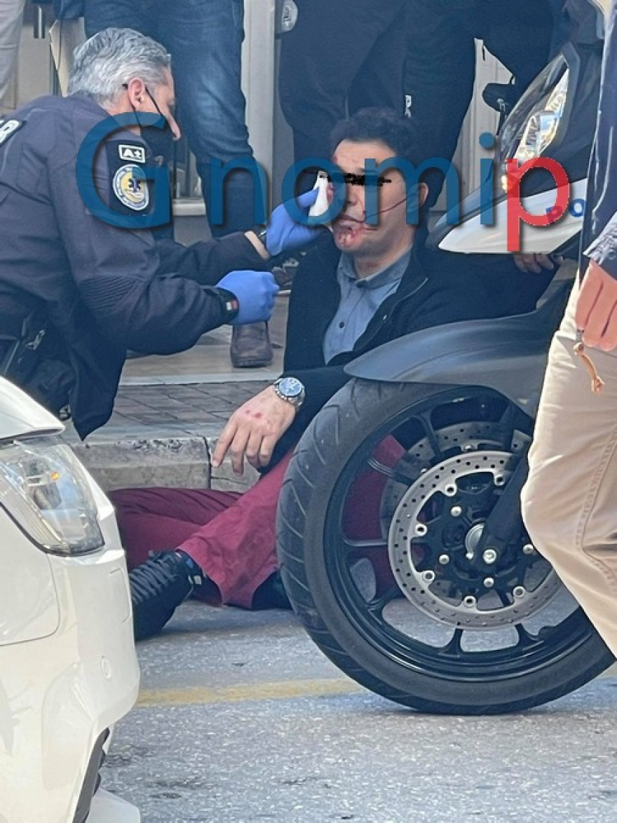 Πάτρα: Γροθιές για μια προσπέραση! Δείτε βίντεο