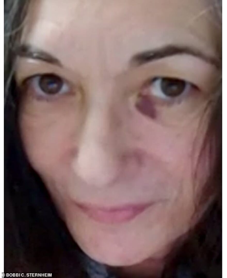 Γκισλέιν Μάξγουελ: Στη δημοσιότητα φωτογραφία της μέσα από τη φυλακή με μελανιά στο μάτι