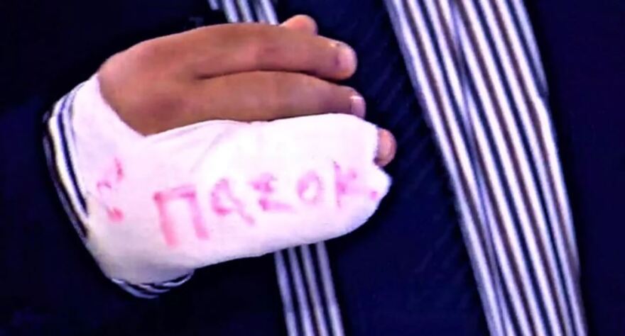 ΣΚΑΪ: Με γύψο... ΠΑΣΟΚ εμφανίστηκε στην εκπομπή ο Γιάννης Ντζούνος