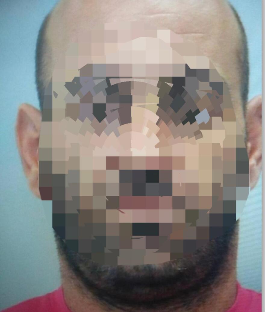 Γλυφάδα: Πολίτες... έπιασαν διαρρήκτη - Έχει συλληφθεί 102 φορές! 