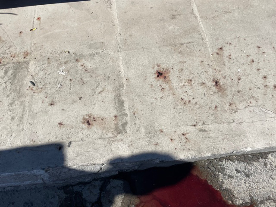 Δολοφονία στη Μεταμόρφωση: Ξεκαθάρισμα λογαριασμών μεταξύ «νονών» της νύχτας «βλέπει» η Αστυνομία