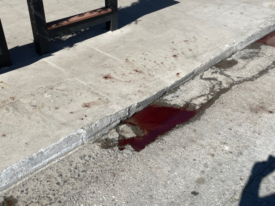 Δολοφονία στη Μεταμόρφωση: Ξεκαθάρισμα λογαριασμών μεταξύ «νονών» της νύχτας «βλέπει» η Αστυνομία