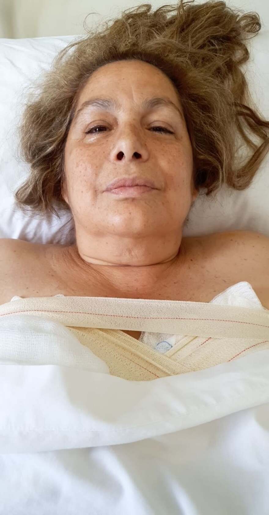 Τζένη Χειλουδάκη: Το δύσκολο χειρουργείο και οι πρώτες φωτογραφίες 