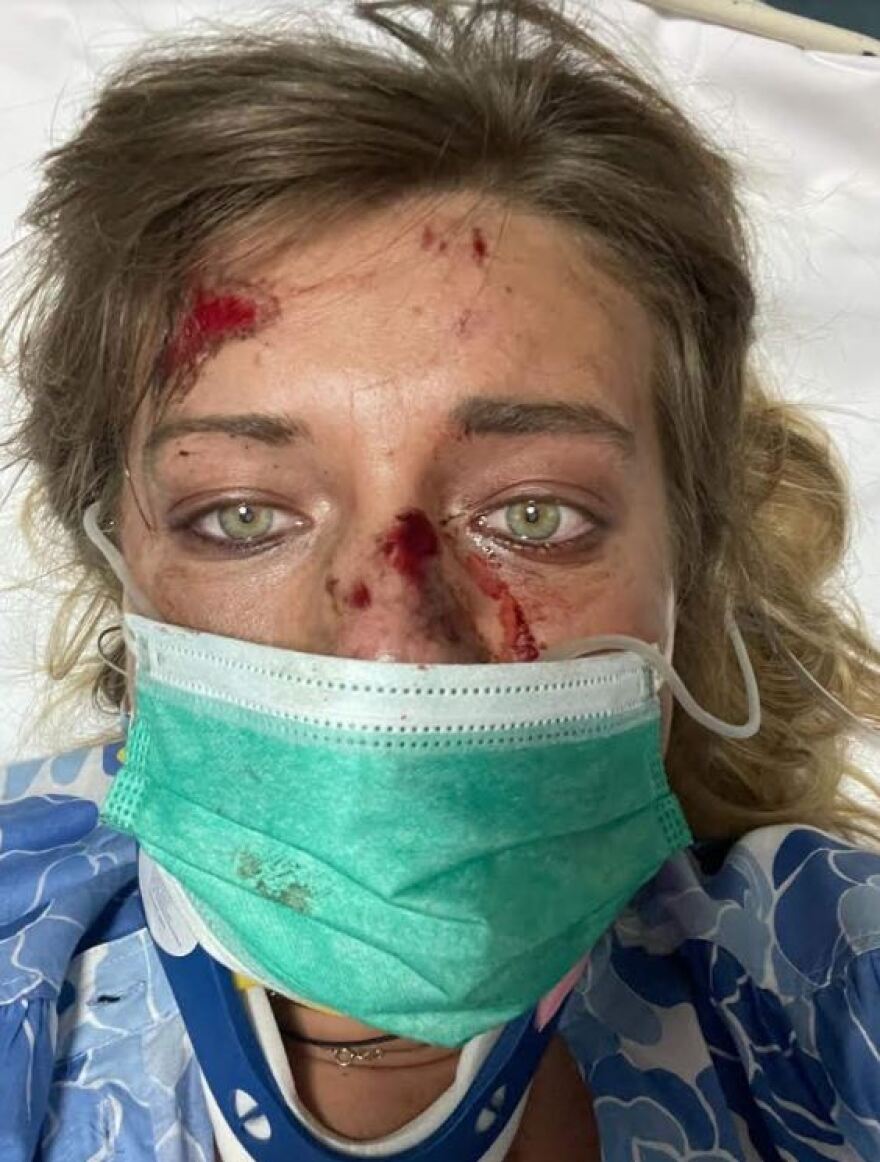 Μηχανή παρέσυρε ποδηλάτισσα και την εκσφενδόνισε στα 10 μέτρα - Τι λέει η ίδια στο protothema.gr