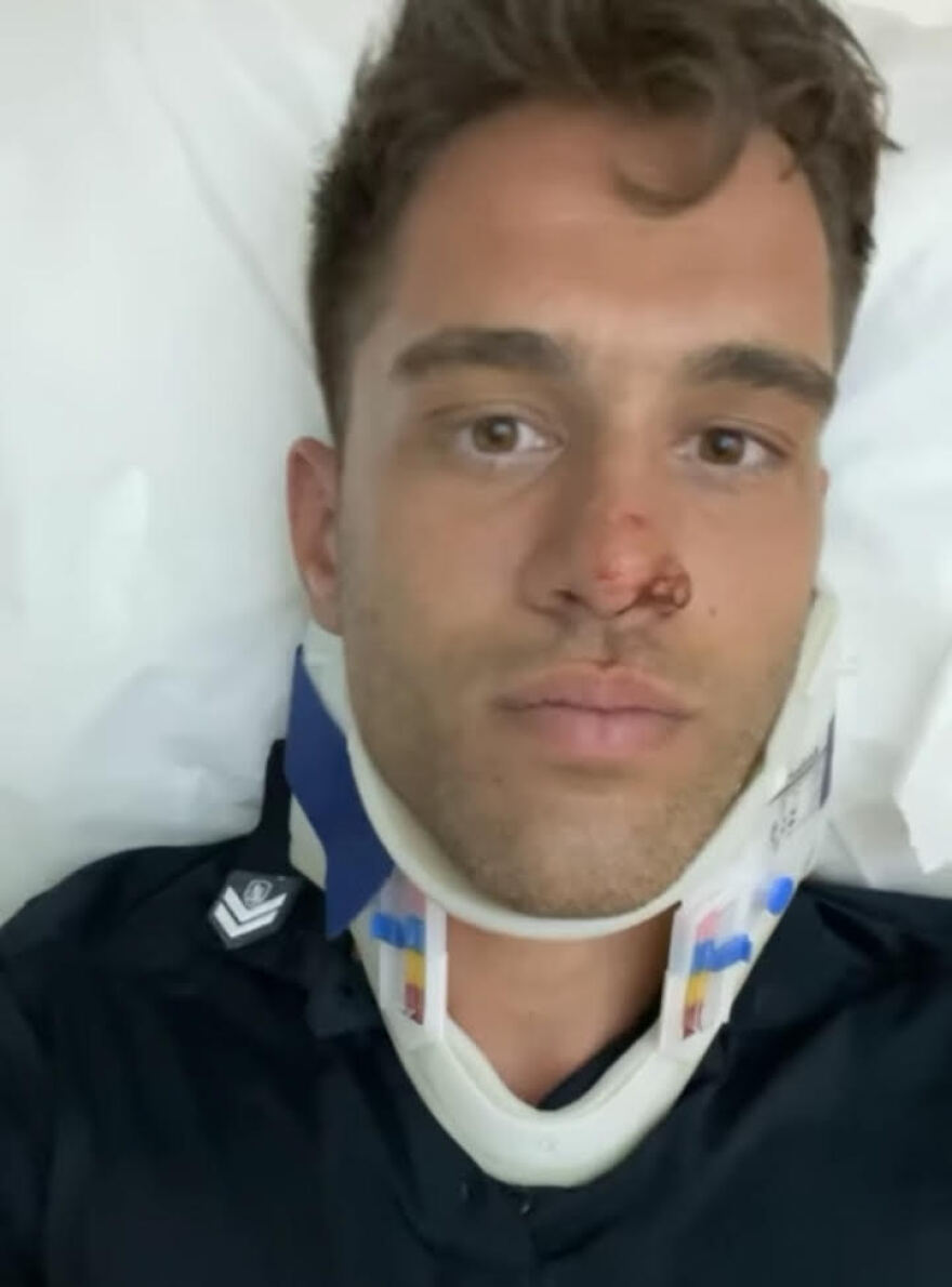 Αστυνομικός - κικ μπόξερ έπεσε από ύψος 10 μέτρων στην προσπάθειά του να συλλάβει διαρρήκτη - Δείτε εικόνες