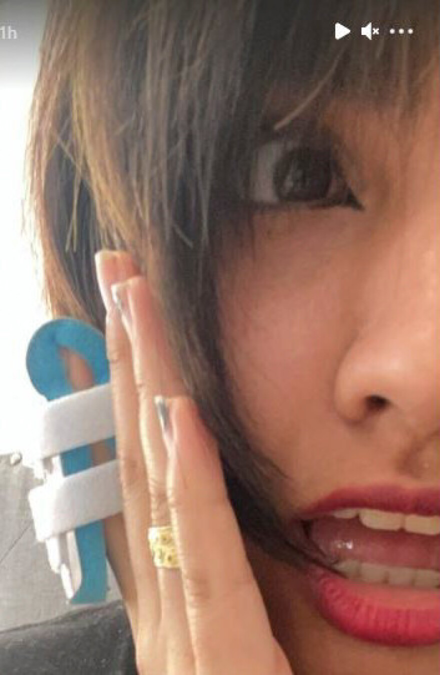 Νεαρή Καλιφορνέζα «τα έβαλε» με... αρκούδα για να προστατέψει τα σκυλιά της - Δείτε βίντεο