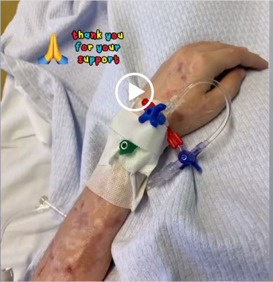 Επίθεση με βιτριόλι: Η Ιωάννα μέσα από το νοσοκομείο δείχνει τα εγκαύματα στο χέρι της - Φωτογραφία 