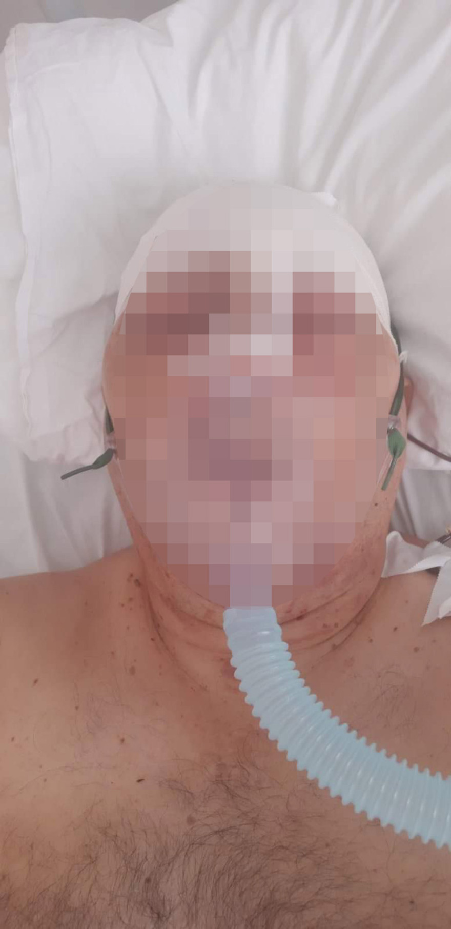 Παξοί: Αλβανός αγρότης σακάτεψε αστυνομικό με σιδερολοστό - Καταδικάστηκε σε κάθειρξη εννέα ετών