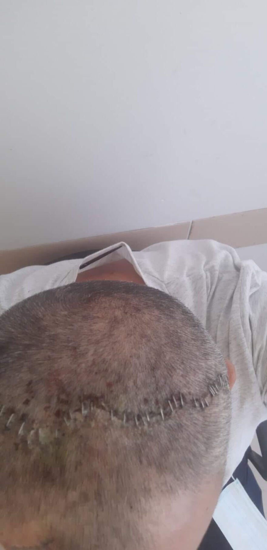 Παξοί: Αλβανός αγρότης σακάτεψε αστυνομικό με σιδερολοστό - Καταδικάστηκε σε κάθειρξη εννέα ετών