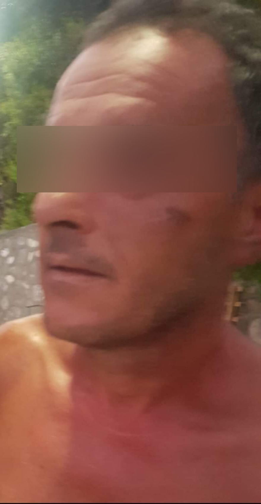 Συγκλονίζει ο αστυνομικός που έπεσε θύμα άγριας επίθεσης: Με χτυπούσε αλύπητα με σιδερολοστό ο αγρότης