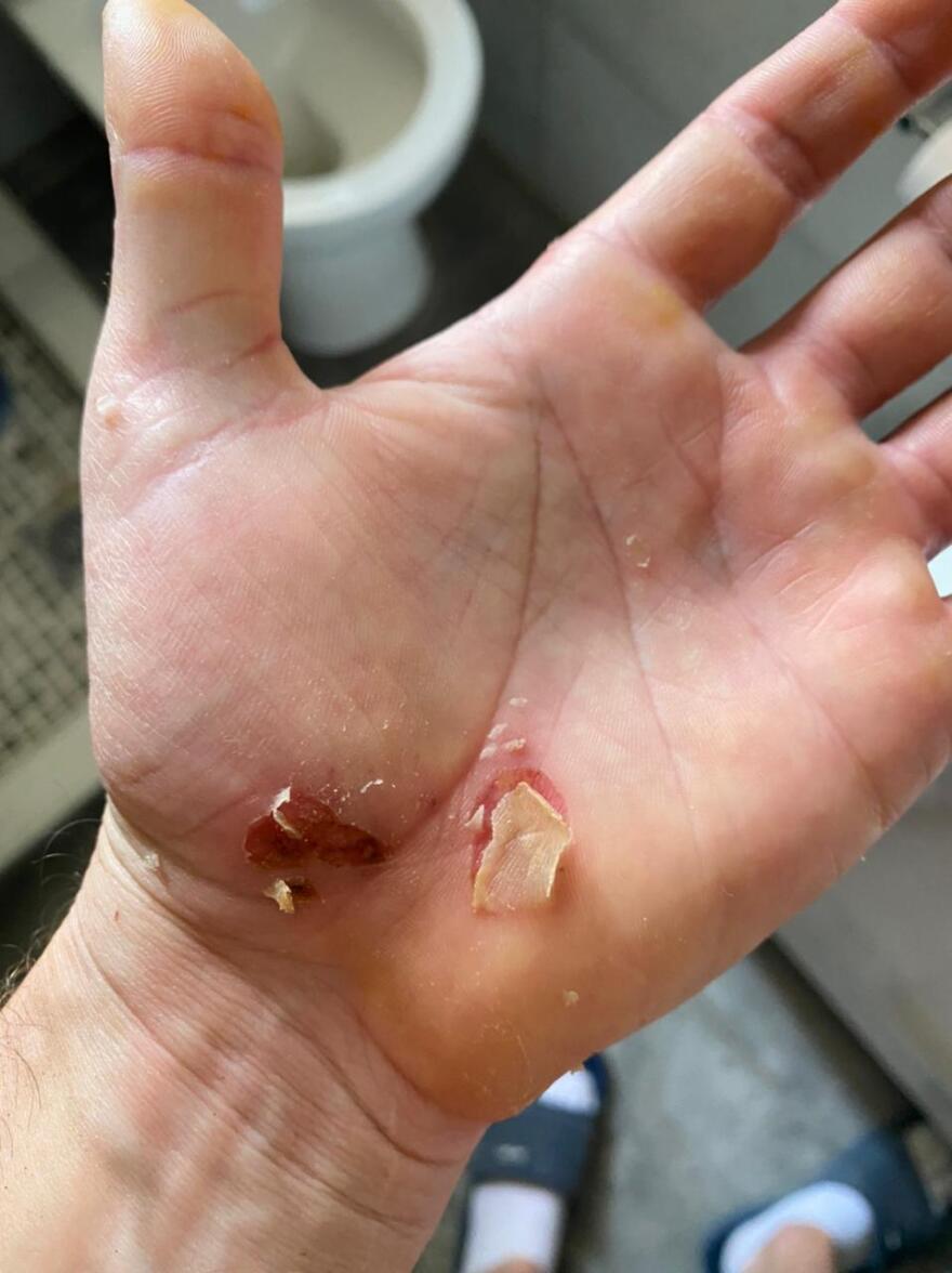 Μετς: Πατέρας και γιος έβαλαν ροτβάιλερ να επιτεθεί σε 30χρονο - Φωτογραφίες