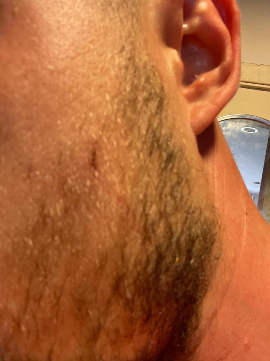 Μετς: Πατέρας και γιος έβαλαν ροτβάιλερ να επιτεθεί σε 30χρονο - Φωτογραφίες