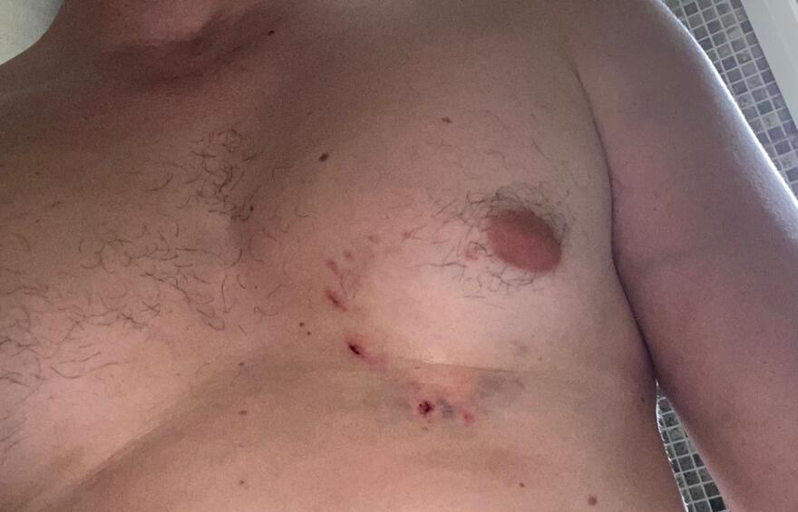 Μετς: Πατέρας και γιος έβαλαν ροτβάιλερ να επιτεθεί σε 30χρονο - Φωτογραφίες