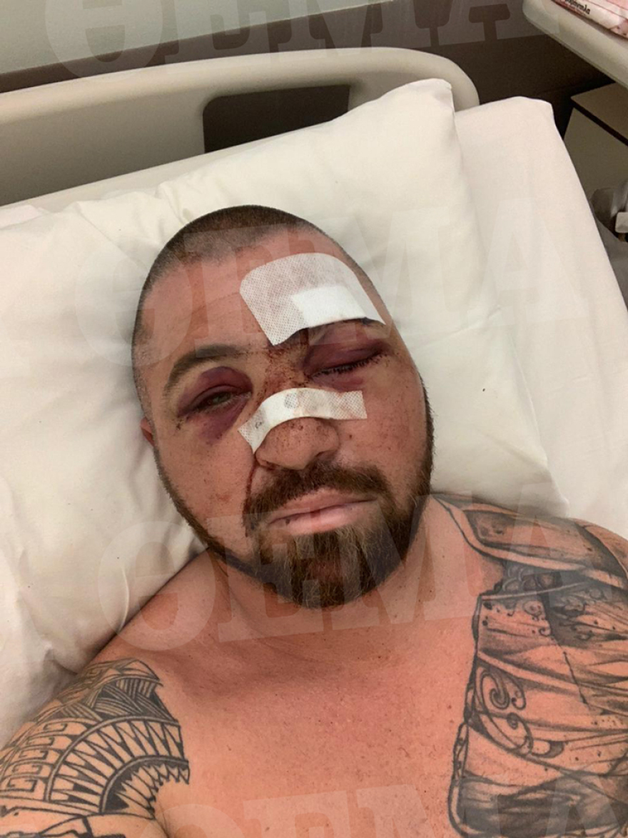 Ο σωματοφύλακας του Νταν Μπιλζέριαν στο protothema.gr: «Eίμαι τυχερός που ζω, με λιθοβολούσαν με μεγάλες πέτρες»