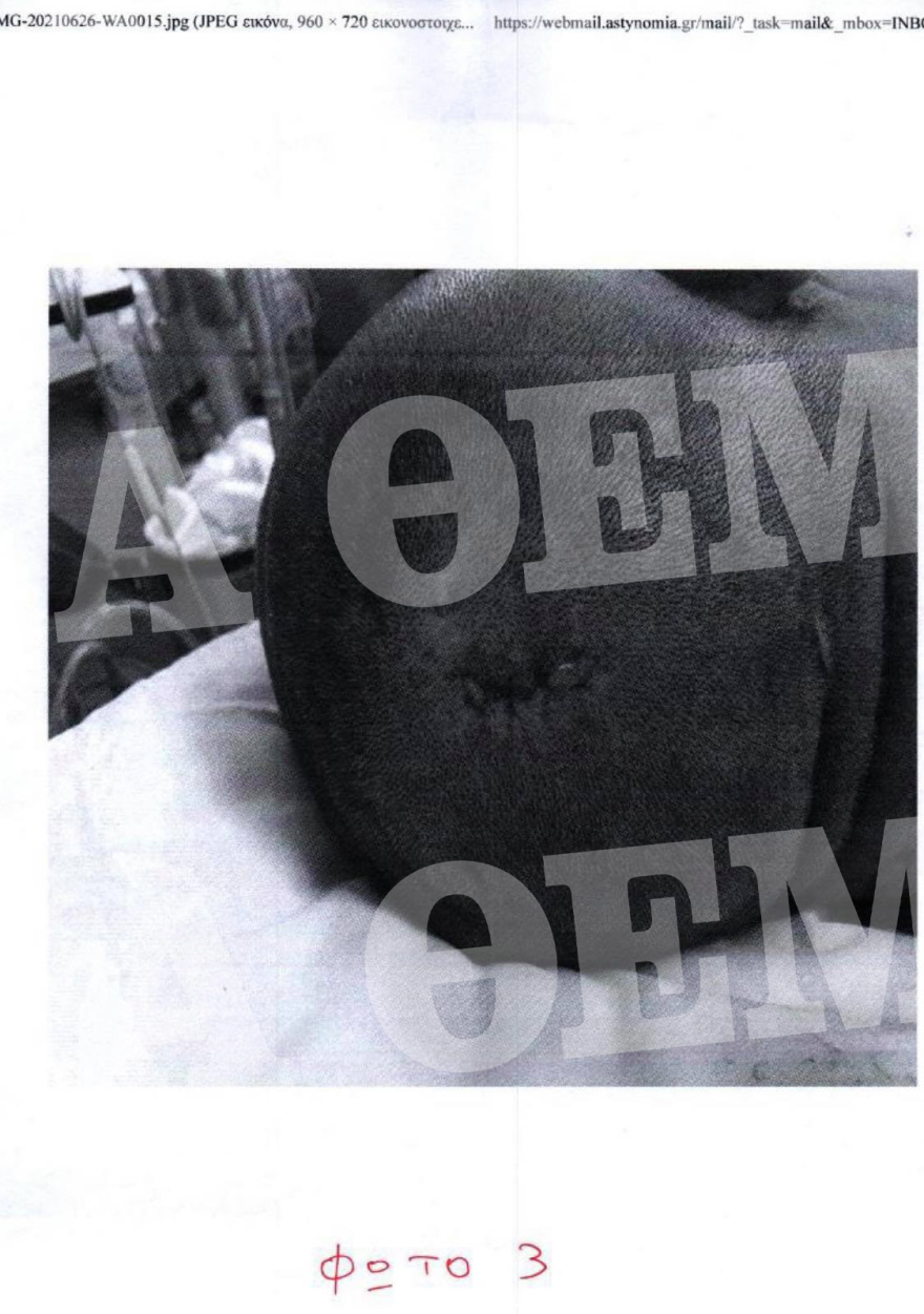 Μύκονος: Καρέ-καρέ ο άγριος ξυλοδαρμός του σωματοφύλακα του Νταν Μπιλζέριαν - Του χτυπούσαν το κεφάλι στον τοίχο